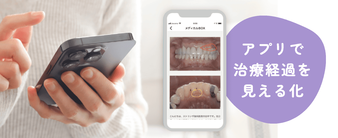 アプリで治療経過を見える化